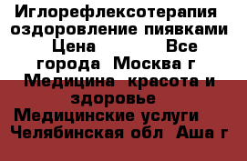 Иглорефлексотерапия, оздоровление пиявками › Цена ­ 3 000 - Все города, Москва г. Медицина, красота и здоровье » Медицинские услуги   . Челябинская обл.,Аша г.